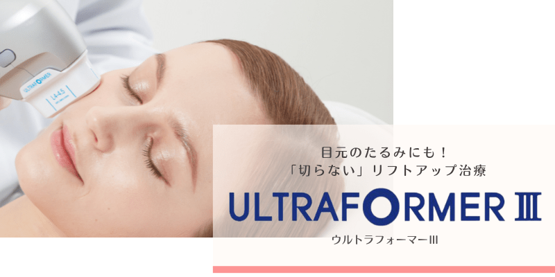 HIFU（ハイフ）：ウルトラフォーマーⅢ