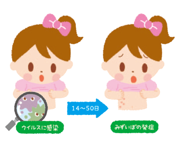 水イボ（伝染性軟属腫）の潜伏期間