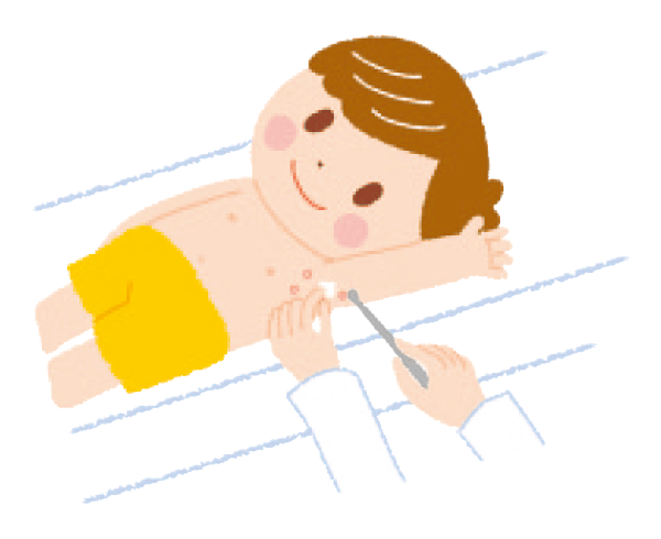 水イボ（伝染性軟属腫）の治療