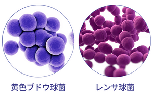 とびひ（伝染性膿痂疹）の原因となる細菌