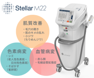 フォトフェイシャル最上位機種「Stellar M22(ステラM22)」