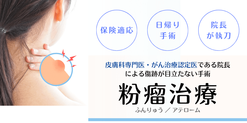 粉瘤（ふんりゅう・アテローム）日帰り手術