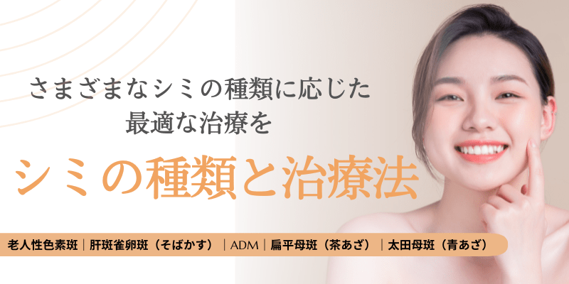 シミ（老人性色素斑・肝斑・そばかす）の種類と治療法