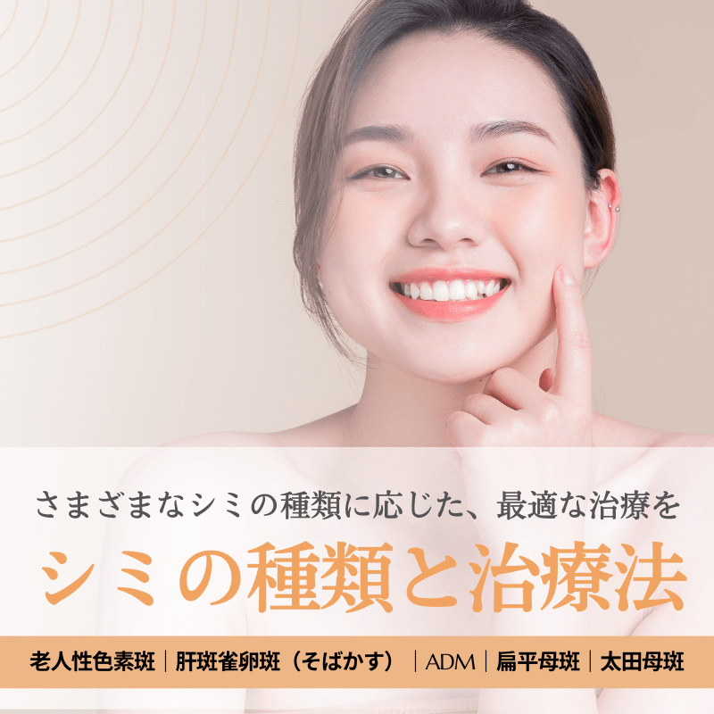 シミ（老人性色素斑・肝斑・そばかす）の種類と治療法