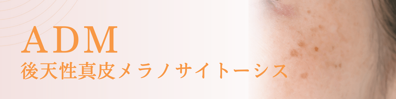 ADM（後天性真皮メラノサイト―シス）の治療法