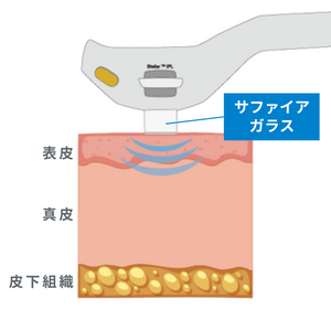 痛みが軽減