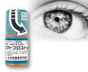 ビマトプロストとは
