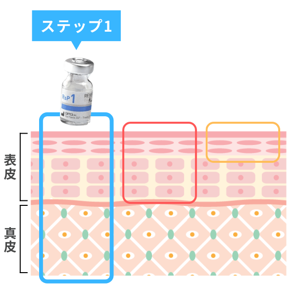 肝斑治療に有効な革新的リバースピール(REVERSE PEEL)ーステップ1:真皮層