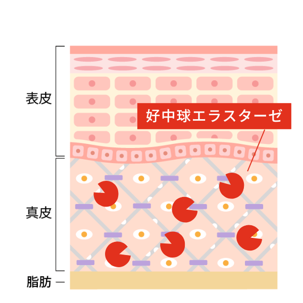 ニールワン®のシワブロック機能2