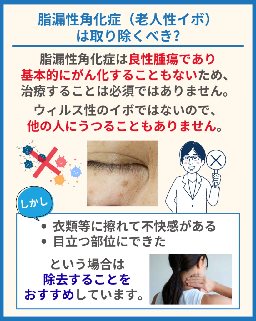 脂漏性角化症(老人性イボ)は取り除くべき?