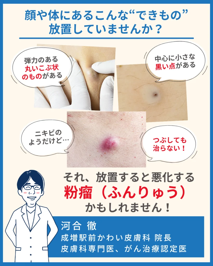 顔や体にあるこんな“できもの”放置していませんか?