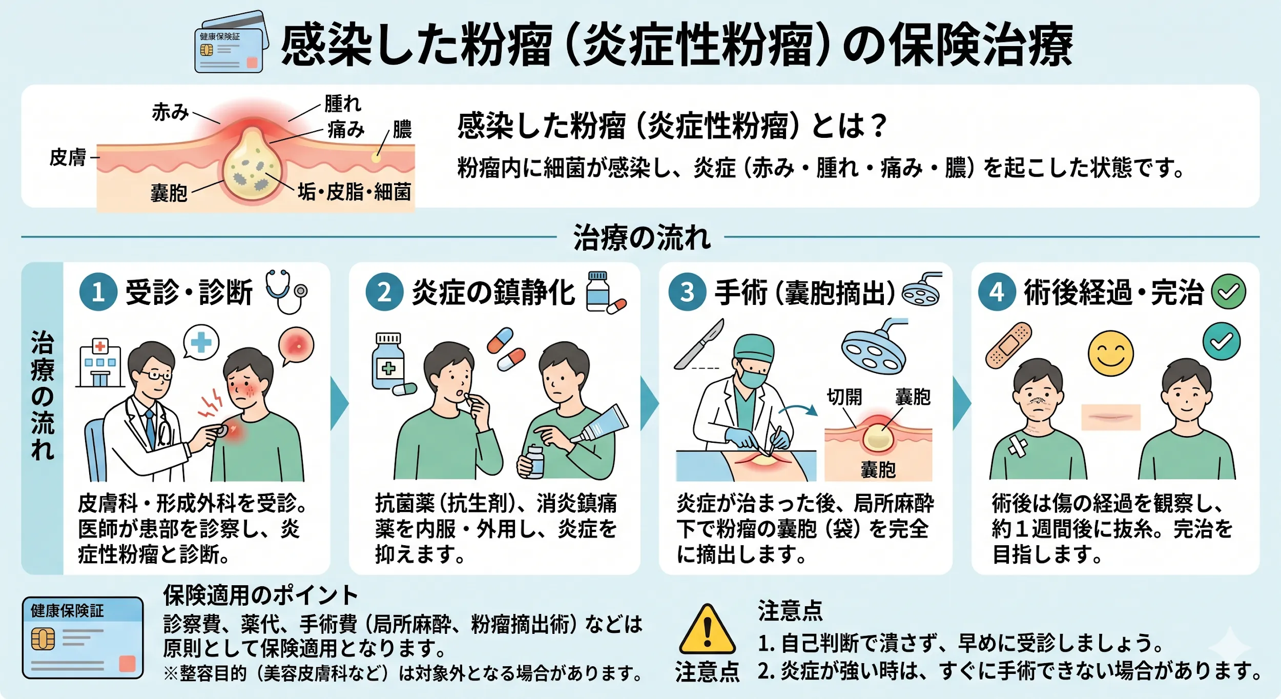 感染した粉瘤（炎症性粉瘤）の保険治療